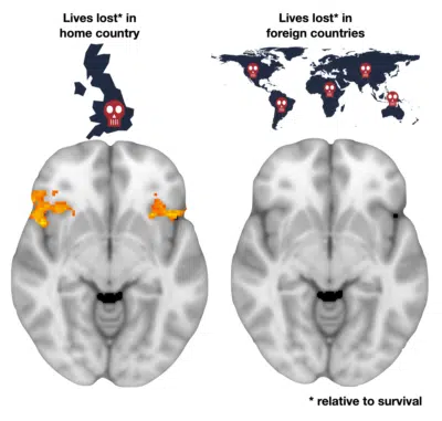 Two brain scans